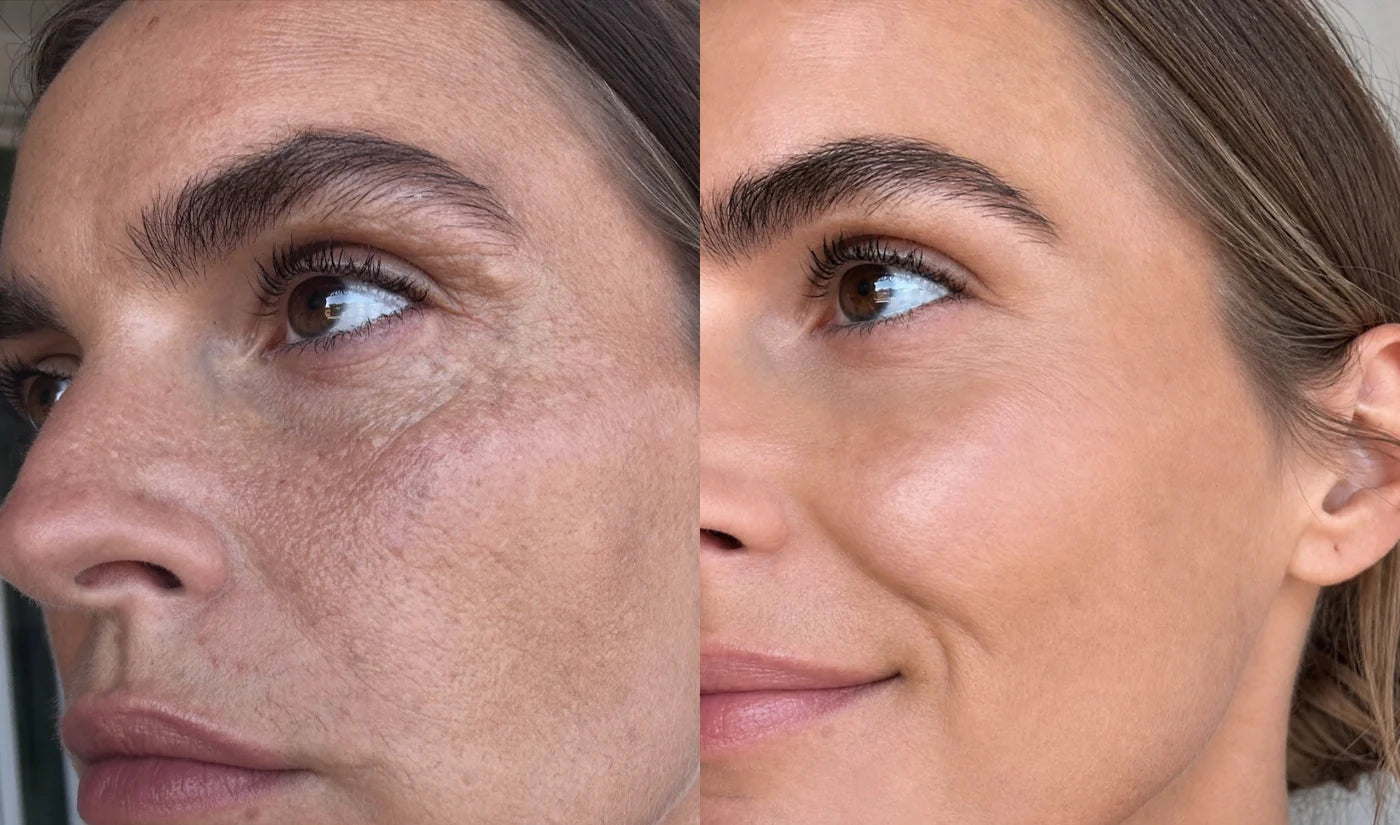 Rachel, 43