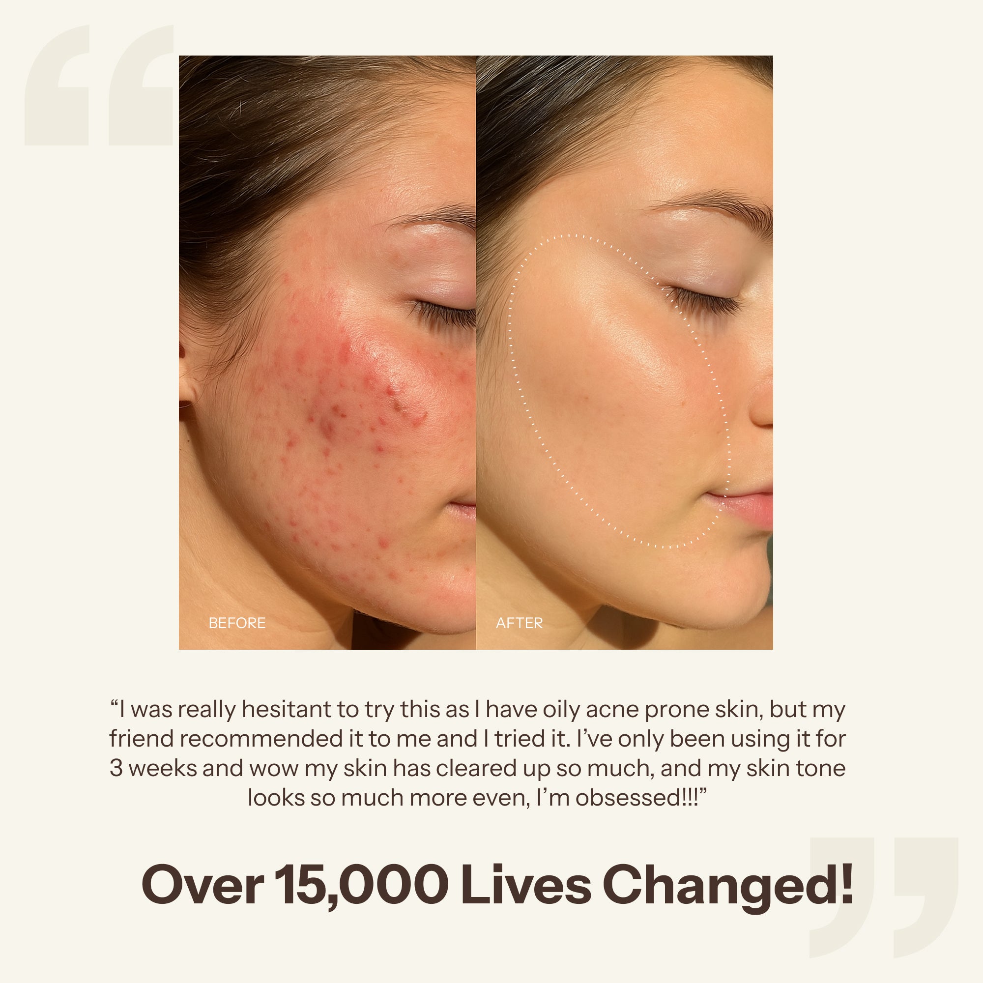 Tallow Facial Moisturizer