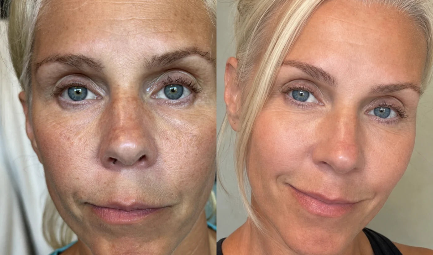 Lauren, 50