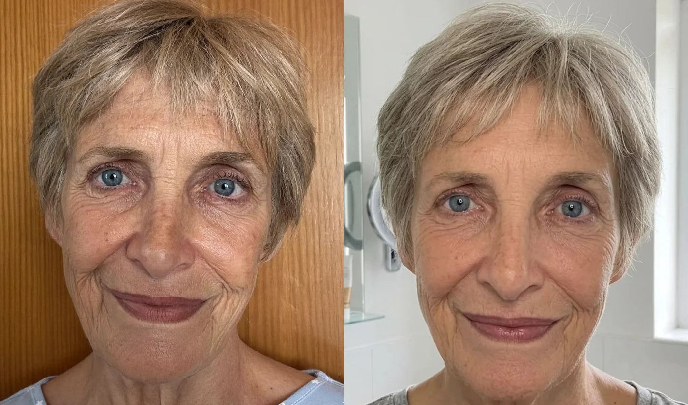 Patricia, 66