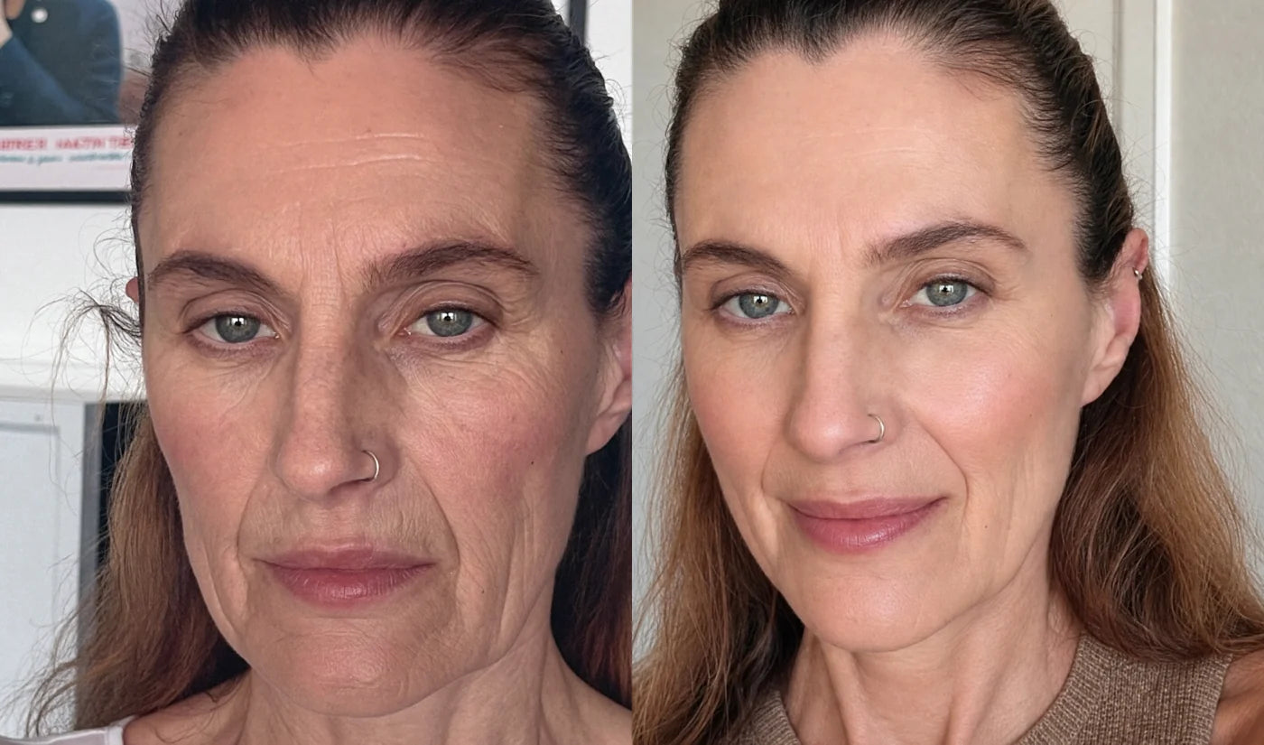 Nicole, 50